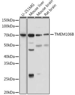 TMEM106B Rabbit anti-Human, Mouse, Rat, Polyclonal, Novus Biologicals:Antibodies:Primary
