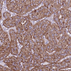 TMEM106C Antibody, Novus Biologicals:Antibodies:Primary Antibodies