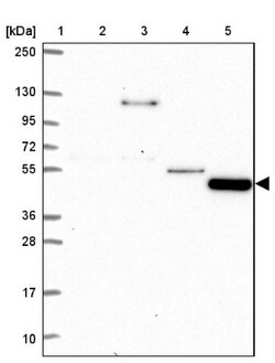 TMEM108 Antibody, Novus Biologicals:Antibodies:Primary Antibodies