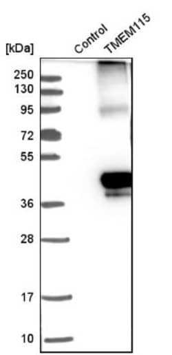 TMEM115 Antibody, Novus Biologicals 0.1mL; Unlabeled:Antibodies, Polyclonal