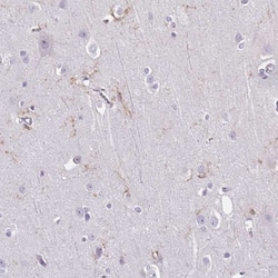 TMEM119 Antibody, Novus Biologicals 0.1mL; Unlabeled:Antibodies, Polyclonal