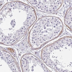 TMEM119 Antibody, Novus Biologicals 0.1mL; Unlabeled:Antibodies, Polyclonal