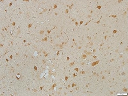 TMEM119 Antibody, Novus Biologicals 0.1mL; Unlabeled:Antibodies, Polyclonal