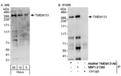 TMEM131 Antibody, Novus Biologicals 0.1mg; Unlabeled:Antibodies, Polyclonal