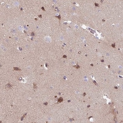 TMEM132A Antibody, Novus Biologicals 25ul | Buy Online | Novus Biologicals | Fisher Scientific