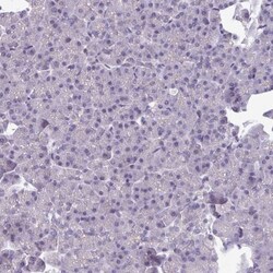 TMEM132A Antibody, Novus Biologicals 25ul | Buy Online | Novus Biologicals | Fisher Scientific