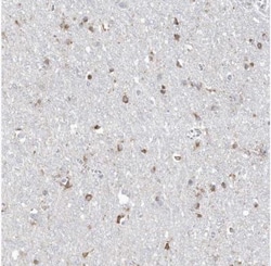 TMEM132B Antibody, Novus Biologicals:Antibodies:Primary Antibodies