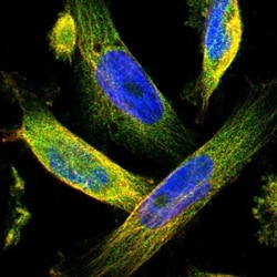 TMEM132C Antibody, Novus Biologicals 0.1mL; Unlabeled:Antibodies, Polyclonal