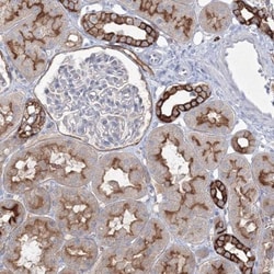 TMEM139 Antibody, Novus Biologicals:Antibodies:Primary Antibodies