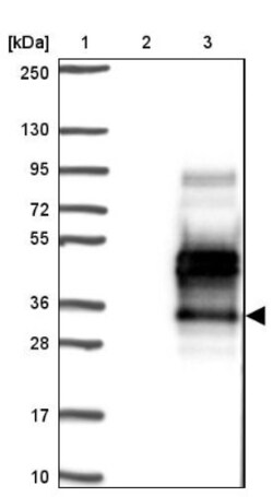 TMEM139 Antibody, Novus Biologicals:Antibodies:Primary Antibodies