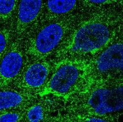 TMEM141 Antibody, Novus Biologicals 25 &mu;L; Unlabeled:Antibodies, Polyclonal
