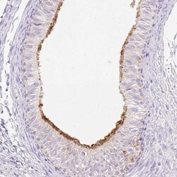 TMEM150C Antibody, Novus Biologicals:Antibodies:Primary Antibodies
