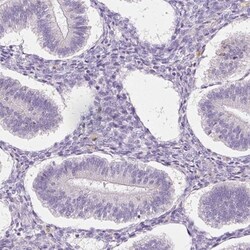 TMEM150C Antibody, Novus Biologicals:Antibodies:Primary Antibodies