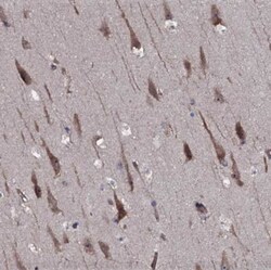 TMEM151A Antibody, Novus Biologicals 0.1 mL | Buy Online | Novus Biologicals | Fisher Scientific