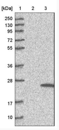 TMEM159 Antibody, Novus Biologicals 25ul | Buy Online | Novus Biologicals | Fisher Scientific