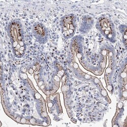 TMEM165 Antibody, Novus Biologicals:Antibodies:Primary Antibodies