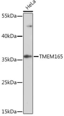 TMEM165 Rabbit anti-Human, Polyclonal, Novus Biologicals 100 &mu;g; Unconjugated:Antibodies,