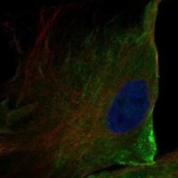 TMEM16K Rabbit anti-Human, Polyclonal, Novus Biologicals 25 &mu;g; Unconjugated:Antibodies,