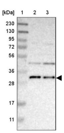 TMEM17 Antibody, Novus Biologicals 0.1 mL | Buy Online | Novus Biologicals | Fisher Scientific