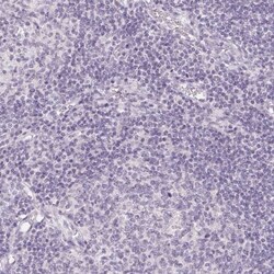 TMEM174 Antibody, Novus Biologicals:Antibodies:Primary Antibodies