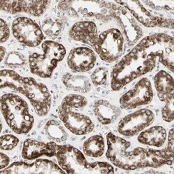 anti-TMEM176A, Polyclonal, Novus Biologicals 0.1mL; Unlabeled:Antibodies,
