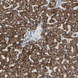 anti-TMEM176A, Polyclonal, Novus Biologicals 0.1mL; Unlabeled:Antibodies,