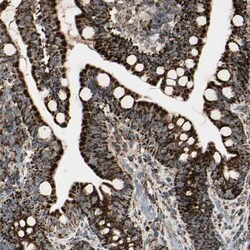 anti-TMEM176A, Polyclonal, Novus Biologicals 0.1mL; Unlabeled:Antibodies,