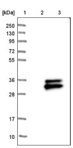anti-TMEM176A, Polyclonal, Novus Biologicals 0.1mL; Unlabeled:Antibodies,