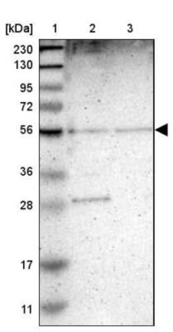 TMEM180 Antibody, Novus Biologicals 0.1mL; Unlabeled:Antibodies, Polyclonal