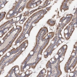 TMEM187 Antibody, Novus Biologicals:Antibodies:Primary Antibodies