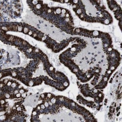 TMEM192 Antibody, Novus Biologicals 25 &mu;L | Buy Online | Novus Biologicals | Fisher Scientific