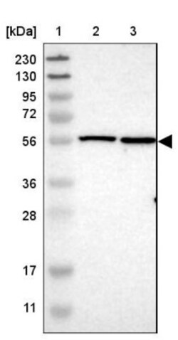 TMEM194A Antibody, Novus Biologicals 25 &mu;L, Unlabeled:Antibodies, Polyclonal