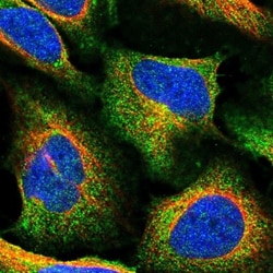 TMEM2 Antibody, Novus Biologicals:Antibodies:Primary Antibodies