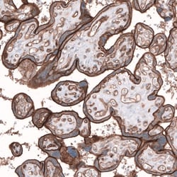 TMEM2 Antibody, Novus Biologicals:Antibodies:Primary Antibodies