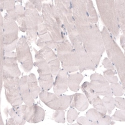 TMEM2 Antibody, Novus Biologicals:Antibodies:Primary Antibodies