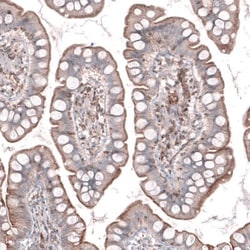 TMEM2 Antibody, Novus Biologicals:Antibodies:Primary Antibodies