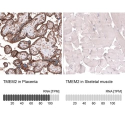 TMEM2 Antibody, Novus Biologicals:Antibodies:Primary Antibodies