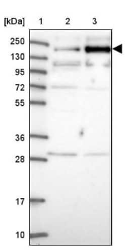TMEM2 Antibody, Novus Biologicals:Antibodies:Primary Antibodies