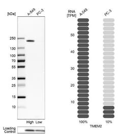 TMEM2 Antibody, Novus Biologicals:Antibodies:Primary Antibodies