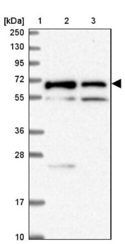 TMEM200C Antibody, Novus Biologicals:Antibodies:Primary Antibodies