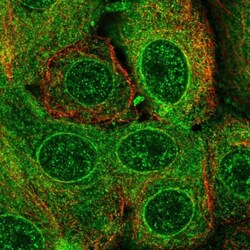 TMEM205 Antibody, Novus Biologicals 0.1mL; Unlabeled:Antibodies, Polyclonal