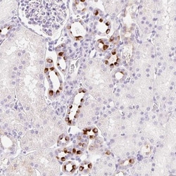 TMEM213 Antibody, Novus Biologicals:Antibodies:Primary Antibodies