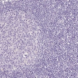 TMEM213 Antibody, Novus Biologicals:Antibodies:Primary Antibodies