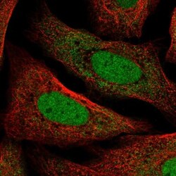 TMEM215 Antibody, Novus Biologicals:Antibodies:Primary Antibodies