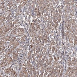 TMEM218 Antibody, Novus Biologicals:Antibodies:Primary Antibodies