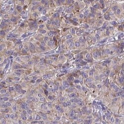 TMEM219 Antibody, Novus Biologicals:Antibodies:Primary Antibodies