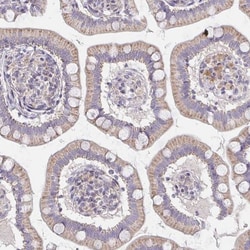 TMEM219 Antibody, Novus Biologicals:Antibodies:Primary Antibodies