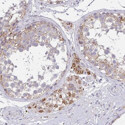 TMEM219 Antibody, Novus Biologicals:Antibodies:Primary Antibodies