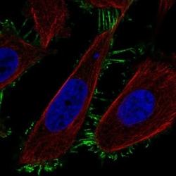TMEM229A Antibody, Novus Biologicals 0.1mL; Unlabeled:Antibodies, Polyclonal