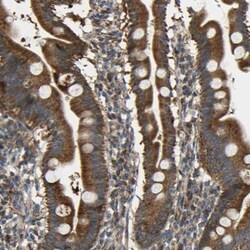 TMEM25 Antibody, Novus Biologicals:Antibodies:Primary Antibodies